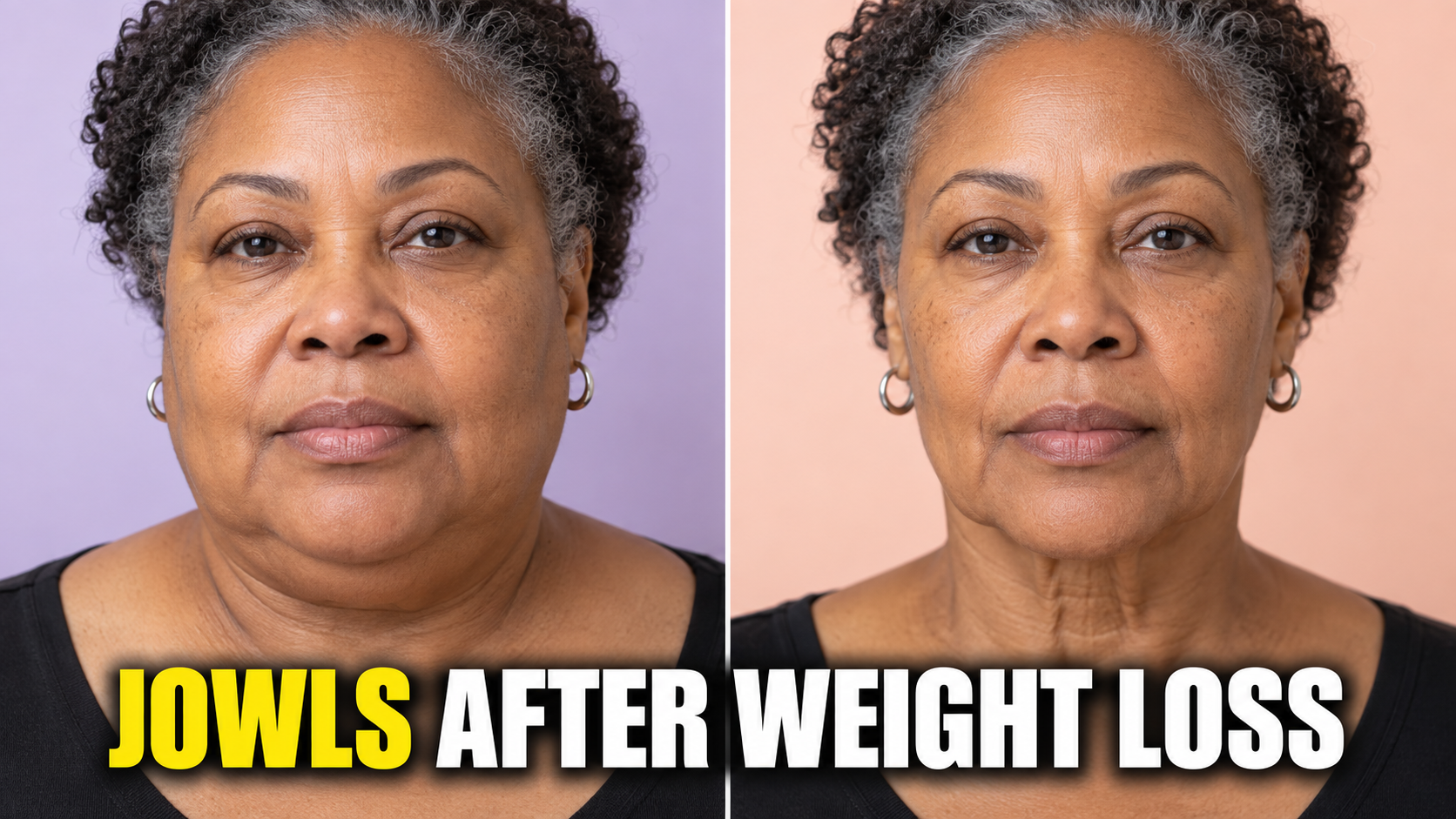 Jowls Before and After Weight Loss